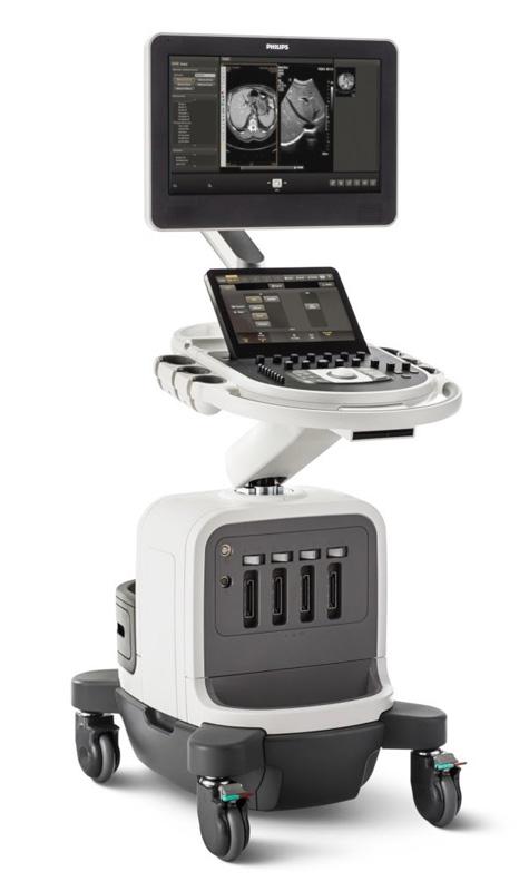 Ultrasound machine Philips Affinity 50